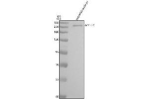 Western blot analysis of MYH10 using anti-MYH10 antibody (AZA0A8M3BA62).