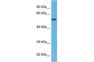 Host:  Rabbit  Target Name:  KL  Sample Tissue:  Human DLD1 Whole Cell  Antibody Dilution:  1ug/ml (Klotho 抗体  (Middle Region))