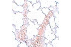 Immunohistochemical staining of rat lung tissue with REEP2 polyclonal antibody  at 5 ug/mL dilution. (REEP2 抗体)