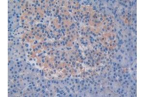 Immunohistochemistry (IHC) image for anti-Ornithine Decarboxylase 1 (ODC1) (AA 15-259) antibody (ABIN7433486)