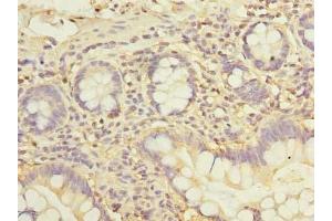Immunohistochemistry (IHC) image for anti-Zinc Finger, DHHC-Type Containing 2 (ZDHHC2) (AA 230-367) antibody (ABIN7162542)