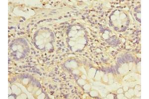 Immunohistochemistry of paraffin-embedded human small intestine tissue using ABIN7162542 at dilution of 1:100