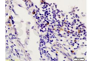 Immunohistochemistry (IHC) image for anti-Signal Transducer and Activator of Transcription 6, Interleukin-4 Induced (STAT6) (AA 601-700) antibody (ABIN738291)