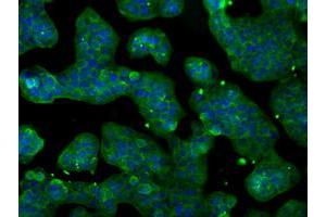 Anti-POR mouse monoclonal antibody (ABIN2453490) immunofluorescent staining of COS7 cells transiently transfected by pCMV6-ENTRY POR (RC202172). (POR 抗体)