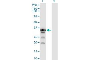 Western Blot analysis of APTX expression in transfected 293T cell line by APTX monoclonal antibody (M02), clone 2H6. (Aprataxin 抗体  (AA 69-166))