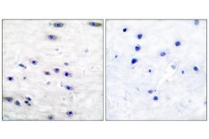Immunohistochemistry (IHC) image for anti-Tyrosine Hydroxylase (TH) (Ser19) antibody (ABIN1847900) (Tyrosine Hydroxylase 抗体  (Ser19))