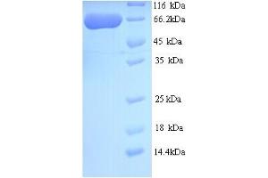 SDS-PAGE (SDS) image for Chromosome 10 Open Reading Frame 2 (C10ORF2) (AA 32-684) protein (His tag) (ABIN5714434)