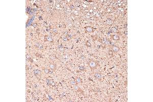 Immunohistochemistry of paraffin-embedded mouse spinal cord using GABA transaminase (GABA transaminase (ABAT)) Rabbit mAb (ABIN7265336) at dilution of 1:100 (40x lens). (ABAT 抗体)