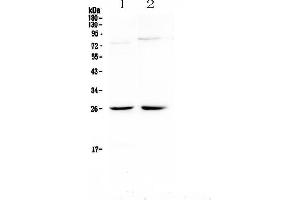Western blot analysis of NMU using anti-NMU antibody . (Neuromedin U 抗体)