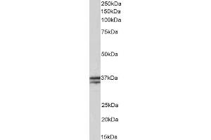 ABIN5539506 (0. (TNNT1 抗体  (Internal Region))