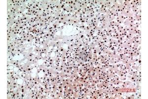 Immunohistochemistry (IHC) analysis of paraffin-embedded Human Liver, antibody was diluted at 1:100. (BCL6 抗体  (Internal Region))