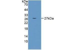 Detection of recombinant CRAT using Polyclonal Antibody to Carnitine Acetyltransferase (CRAT)