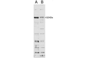 Image no. 2 for anti-SECIS Binding Protein 2 (SECISBP2) (Internal Region) antibody (ABIN374739) (SECISBP2 抗体  (Internal Region))