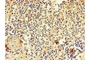 Immunohistochemistry (IHC) image for anti-Solute Carrier Family 2 (Facilitated Glucose Transporter), Member 3 (SLC2A3) (AA 205-269) antibody (ABIN7170119)