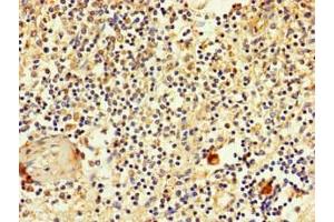 Immunohistochemistry of paraffin-embedded human spleen tissue using ABIN7170119 at dilution of 1:100 (SLC2A3 抗体  (AA 205-269))