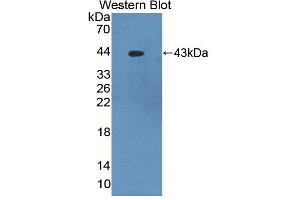 Figure. (PKC delta 抗体  (AA 330-672))