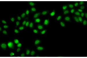 Immunofluorescence analysis of A549 cells using SULT2B1 Polyclonal Antibody (SULT2B1 抗体)