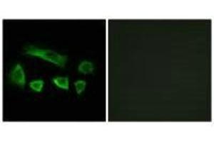 Immunofluorescence analysis of A549 cells, using NT5C1B antibody. (NT5C1B 抗体)
