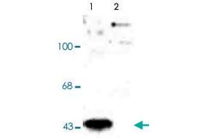 Western blot of human T-47D cells showing specific immunolabeling of the ~45k MAP2K1 (Control). (MEK1 抗体  (pThr386))