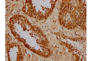 Immunohistochemistry (IHC) image for anti-Heat Shock 70kDa Protein 8 (HSPA8) (AA 2-646) antibody (ABIN7154883)