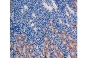Used in DAB staining on fromalin fixed paraffin- embedded kidney tissue (ATM 抗体  (AA 486-742))