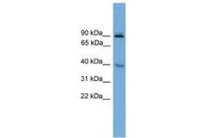 Image no. 1 for anti-L(3)mbt-Like 1 (L3MBTL1) (AA 221-270) antibody (ABIN6744661) (L3MBTL1 抗体  (AA 221-270))