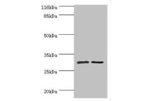 Western blot All lanes: SRPRB antibody at 2 μg/mL Lane 1: HepG2 whole cell lysate Lane 2: Hela whole cell lysate Secondary Goat polyclonal to rabbit IgG at 1/10000 dilution Predicted band size: 30 kDa Observed band size: 30 kDa (SRPRB 抗体  (AA 58-271))