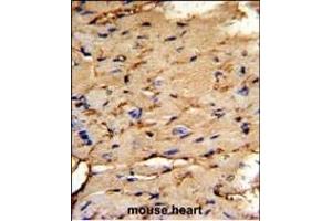 Immunohistochemistry (Paraffin-embedded Sections) (IHC (p)) image for anti-phosphoprotein Enriched in Astrocytes 15 (PEA15) (AA 86-115), (C-Term) antibody (ABIN652463)