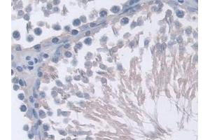 Immunohistochemistry (IHC) image for anti-Protein Phosphatase 2A Activator, Regulatory Subunit 4 (PPP2R4) (AA 1-323) antibody (ABIN7441121)