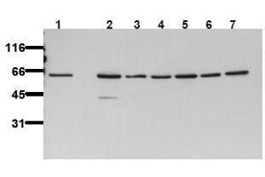 Western Blotting (WB) image for anti-V-Akt Murine Thymoma Viral Oncogene Homolog 2 (AKT2) antibody (ABIN126856) (AKT2 抗体)