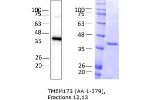 Western Blotting (WB) image for Transmembrane Protein 173 (TMEM173) (AA 1-379) protein (rho-1D4 tag) (ABIN3116214) (STING/TMEM173 Protein (AA 1-379) (rho-1D4 tag))