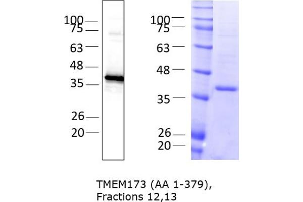STING/TMEM173 Protein (AA 1-379) (rho-1D4 tag)
