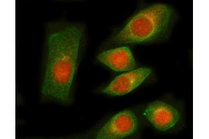 IF analysis of RNGTT and Tubulin beta using anti-RNGTT antibody (ABIN7599723) and anti-Tubulin beta antibody (ABIN7602744).