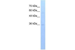 WB Suggested Anti-RFPL3 Antibody Titration:  0. (RFPL3 抗体  (C-Term))