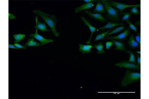 Immunofluorescence of purified MaxPab antibody to SNRPB on HeLa cell.
