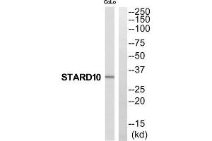 Western Blotting (WB) image for anti-StAR-Related Lipid Transfer (START) Domain Containing 10 (STARD10) (N-Term) antibody (ABIN1852528) (STARD10 抗体  (N-Term))
