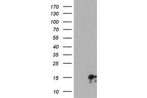 Western Blotting (WB) image for anti-Synaptojanin 2 Binding Protein (SYNJ2BP) antibody (ABIN1501272) (SYNJ2BP 抗体)