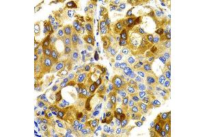 Immunohistochemistry (IHC) image for anti-Cyclin-Dependent Kinase 20 (CDK20) antibody (ABIN3016460) (CCRK 抗体)