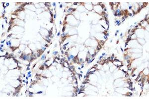 Immunohistochemistry of paraffin-embedded Human colon using HSPA1A Monoclonal Antibody at dilution of 1:100 (40x lens). (HSP70 1A 抗体)