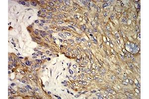 Immunohistochemistry (IHC) image for anti-Keratin 10 (KRT10) (AA 345-454) antibody (ABIN5542470)