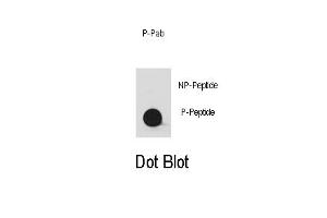 Dot blot analysis of anti-Phospho-YES1-/Phospho-SRC- Antibody (ABIN389661 and ABIN2850452) on nitrocellulose membrane. (YES1/SRC (pTyr530) 抗体)