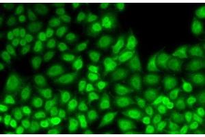 Immunofluorescence analysis of HeLa cells using JUNB Polyclonal Antibody (JunB 抗体)