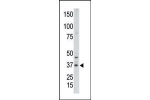 The anti-CDX2 N-term Pab (ABIN390076 and ABIN2840597) is used in Western blot to detect CDX2 in placenta tissue lysate.