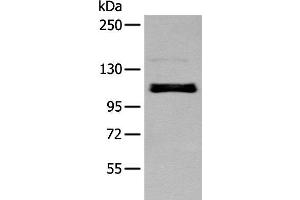 Western blot analysis of A549 cell using ZNF281 Polyclonal Antibody at dilution of 1:250 (ZNF281 抗体)