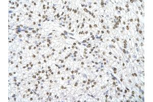 Immunohistochemistry (IHC) image for anti-Sjogren Syndrome Antigen B (SSB) (N-Term) antibody (ABIN2778846)