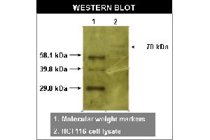 Western blot using RYK antibody   on HCT116 cell lysates. (TXK 抗体)