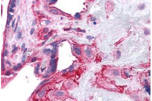 Human Placenta: Formalin-Fixed, Paraffin-Embedded (FFPE) (SNAP23 抗体  (AA 1-132))