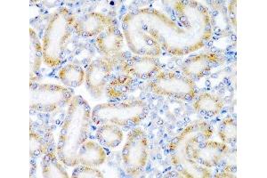 Immunohistochemistry of paraffin-embedded Rat kidney using WRB Polyclonal Antibody at dilution of 1:200 (40x lens). (WRB 抗体)