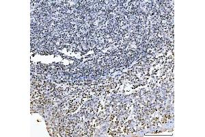 IHC analysis of GADD45B using anti-GADD45B antibody (ABIN7603219).