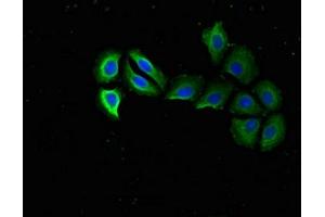 Immunofluorescent analysis of A549 cells using ABIN7142496 at dilution of 1:100 and Alexa Fluor 488-congugated AffiniPure Goat Anti-Rabbit IgG(H+L) (RPS15 抗体  (AA 63-137))